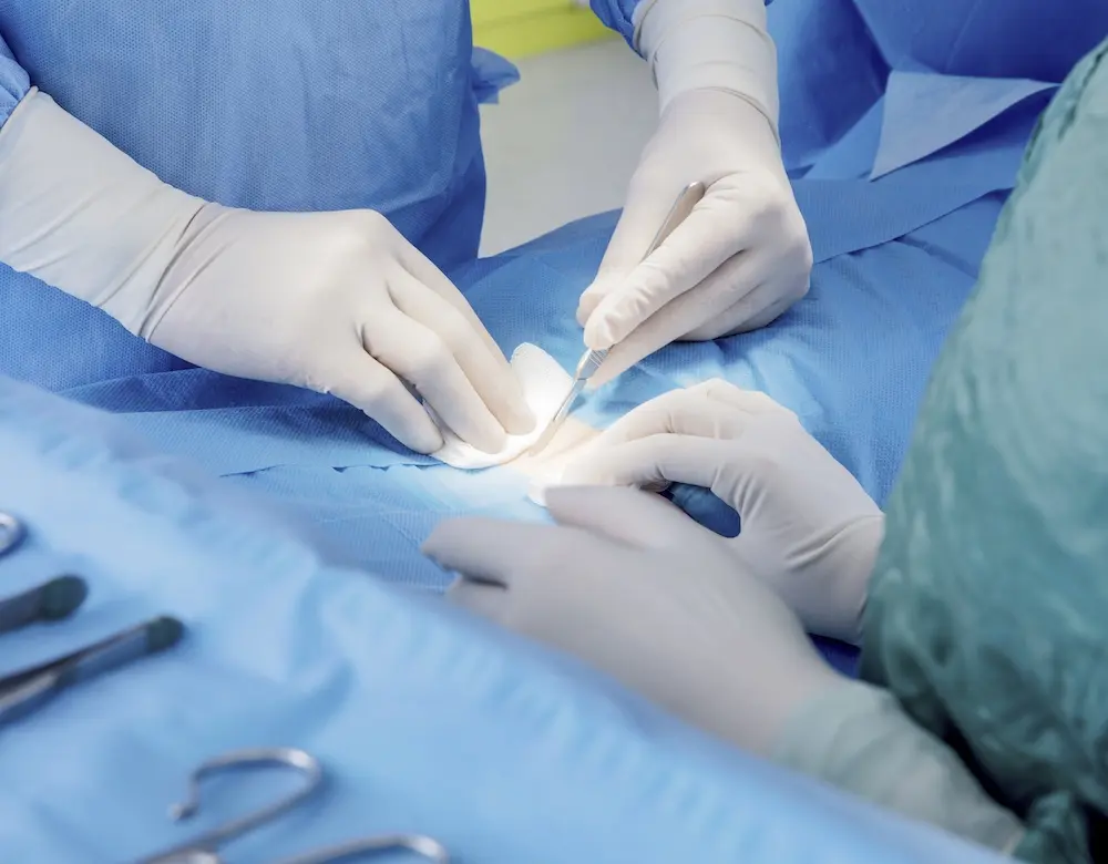 Ärzte nehmen einen kleinen, operativen Eingriff an der Haut eines Patienten vor
