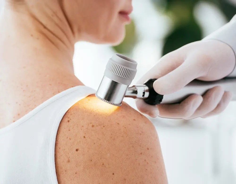 Hautzentrum Kurpark Dermatologie Eine Frau lässt ihre Schulter, die viele Sommersprossen hat, dermatologisch untersuchen